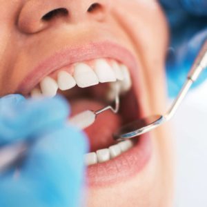 Tratamento de beleza - Odontologia - Clínica estética em São Paulo (SP)